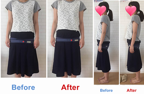 ビフォアーアフター