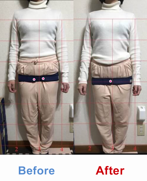 ビフォアーアフター
