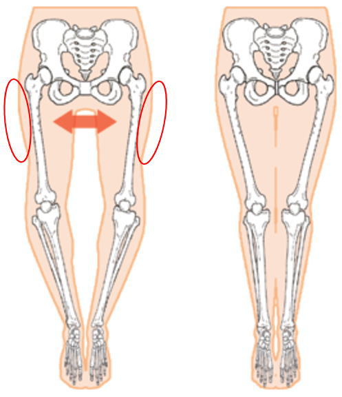 骨盤の下側が広がると太ももが太く