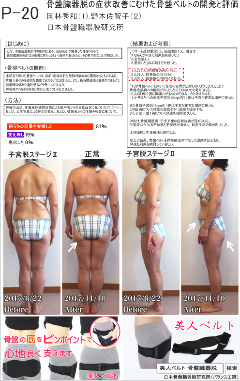 日本女性骨盤底医学会で発表されました。