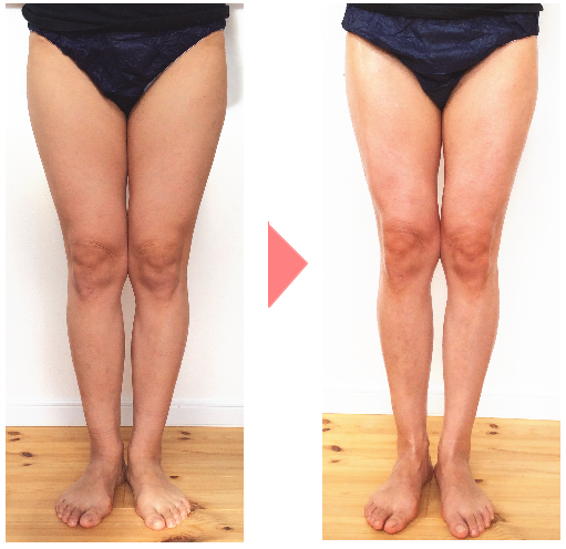 �������������o���G�X�e�P