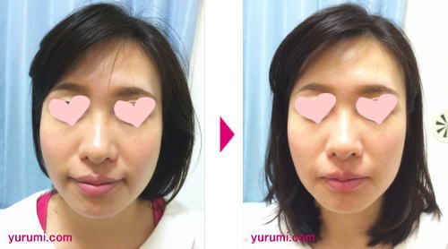 �G�����苸���E���狸���r�t�H�[jpg