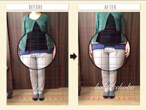 東京 北区 王子本町【王子駅】で産後骨盤矯正before after