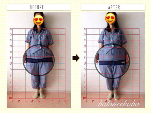 骨盤矯正ビフォーアフター