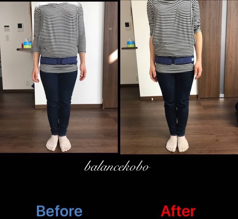 産後骨盤矯正 整体前 整体後