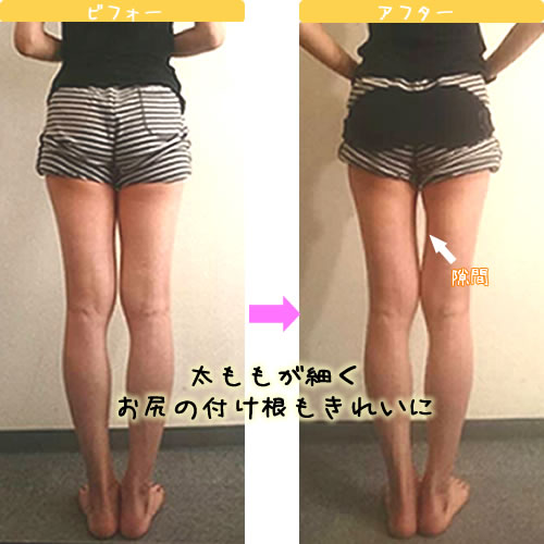 A����r�t�H�[�A�t�^�[�ʐ^