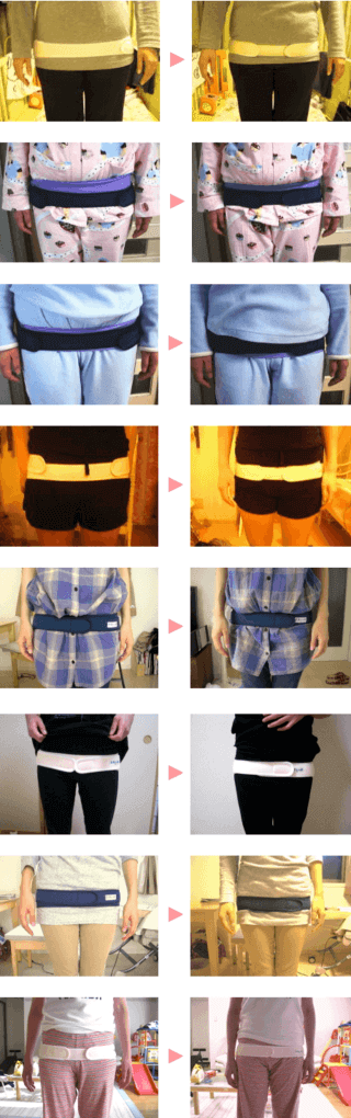 骨盤矯正前と後